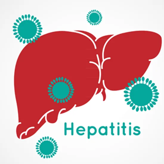 hepatitis e virus (hev), igm antibody quantitative